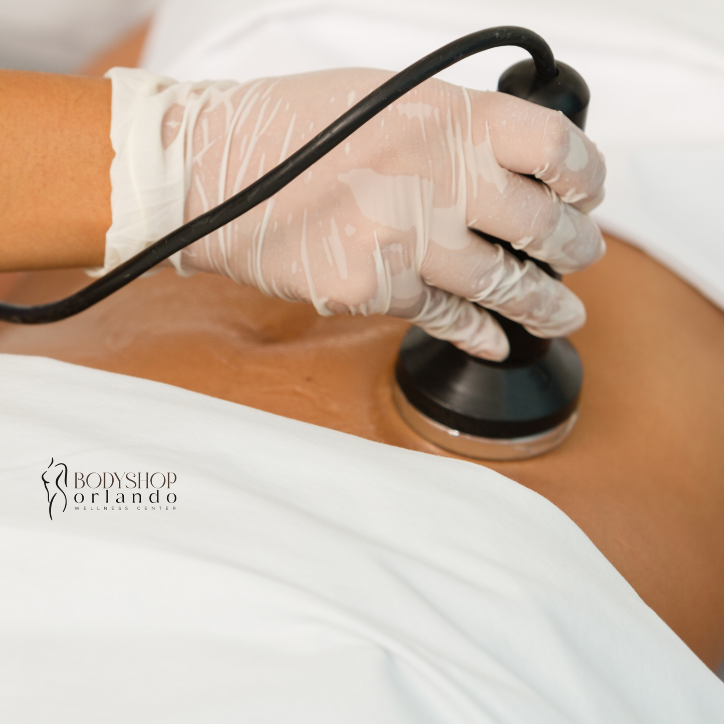 Ultrasonic Cavitation